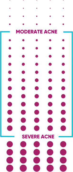 moderate to severe acne